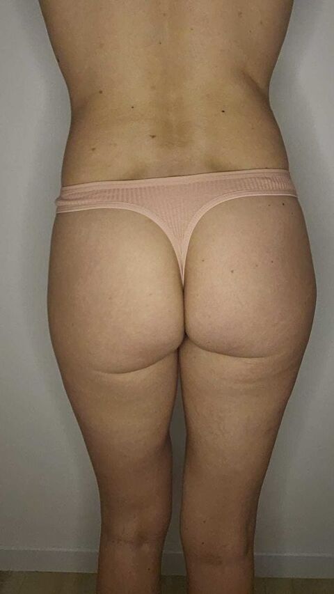 string port�e 15 Avignon (84)