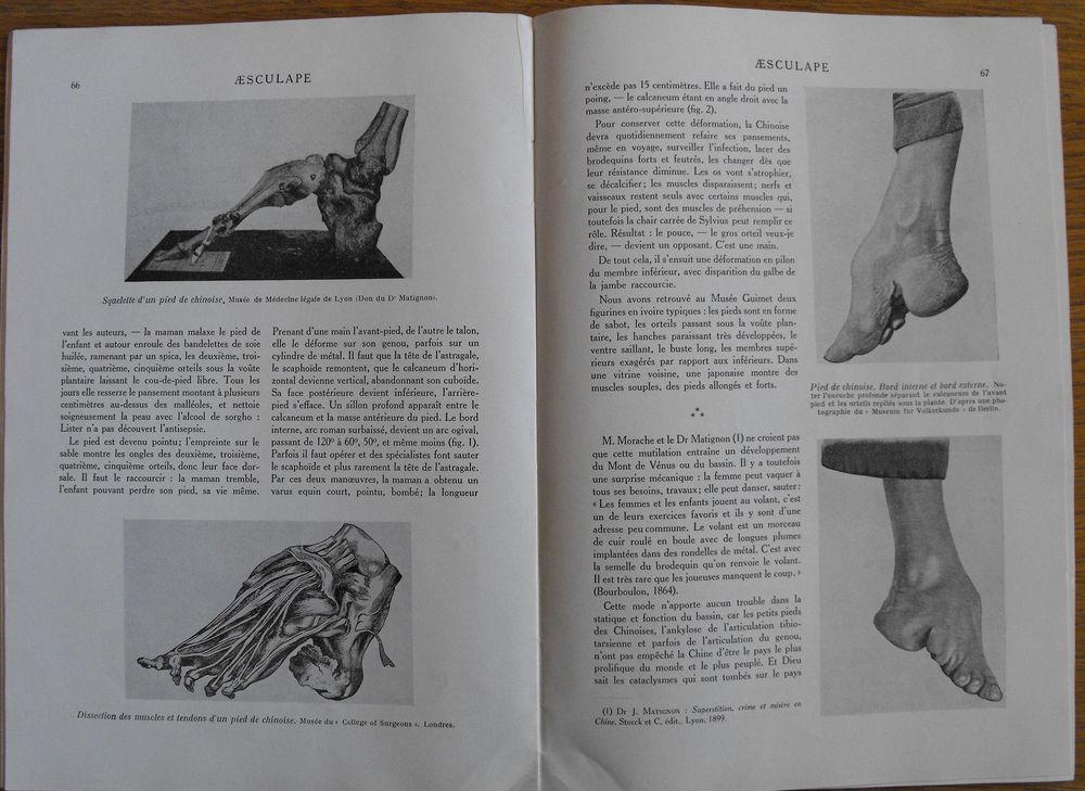 REVUE AESCULAPE N&deg; 3 MARS 1936 Livres et BD