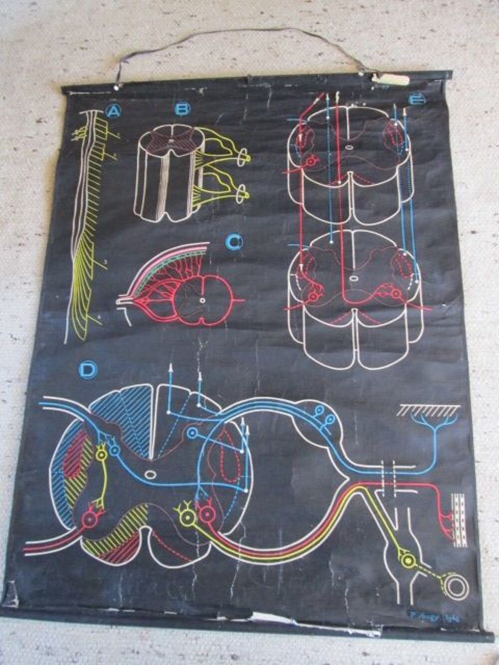 Affiches anciennes anatomie Sougy Auzoux 
