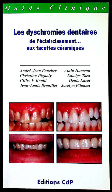 LES DYSCHROMIES DENTAIRES Eclaircissement-Blanchiment dents 35 Gravelines (59)