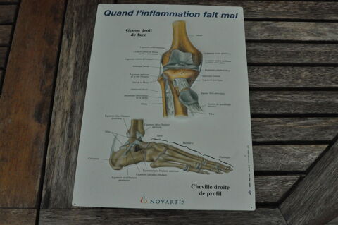 Planche anatomique en relief  genou et cheville  12 Nieuil-l'Espoir (86)