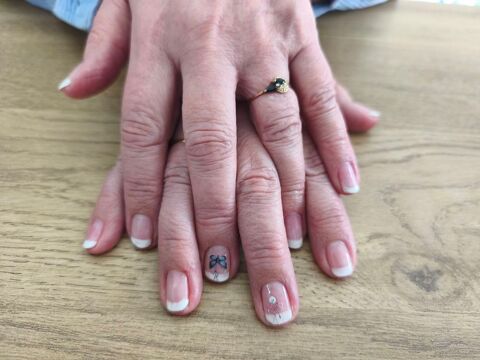 Proth&eacute;siste ongulaire 0 37270 V�retz