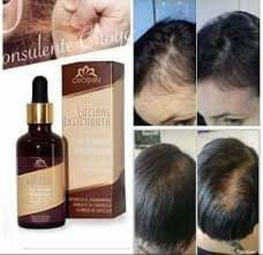 je vous propose un produits anti-chute de cheveux,100% bio. Maroquinerie