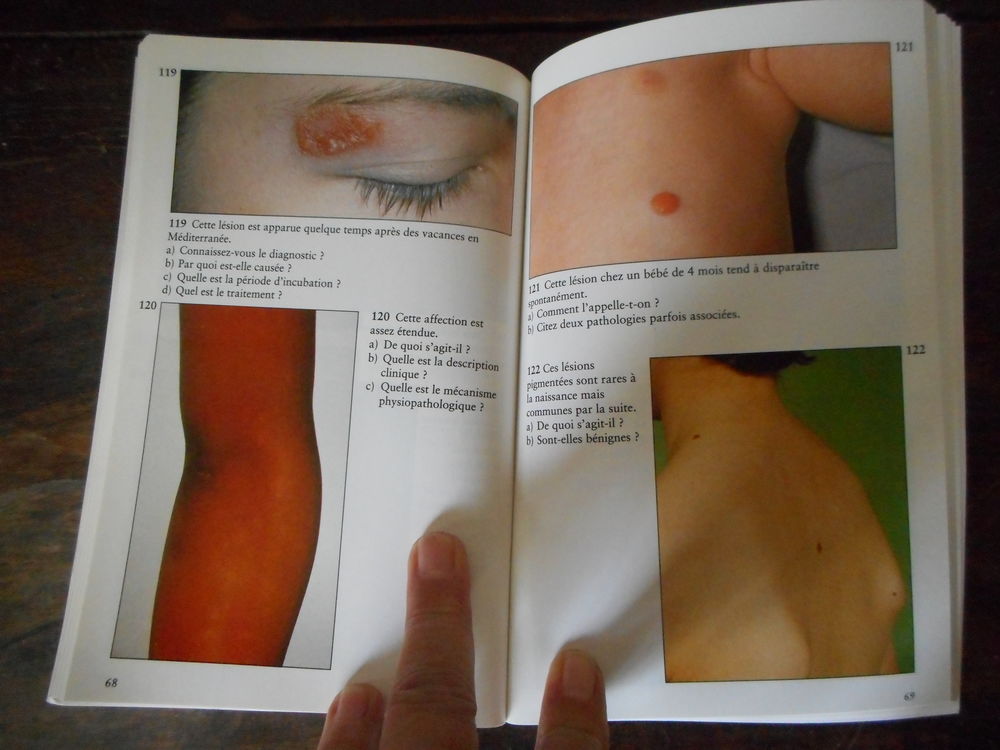 Livre "diagnostic par l'image en dermatologie p&eacute;diatrique" Livres et BD