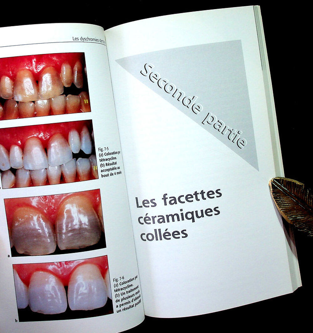 LES DYSCHROMIES DENTAIRES Eclaircissement-Blanchiment dents Livres et BD