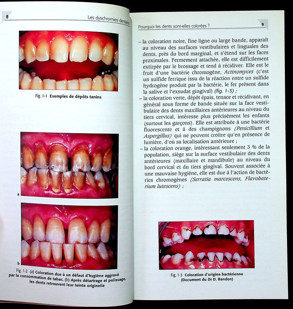 LES DYSCHROMIES DENTAIRES Eclaircissement-Blanchiment dents Livres et BD