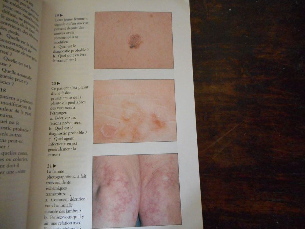 Livre "Diagnostic par l'image en dermatologie clinique" Livres et BD
