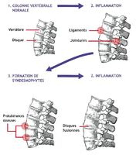   Les Avantages de la magnétothérapie. 