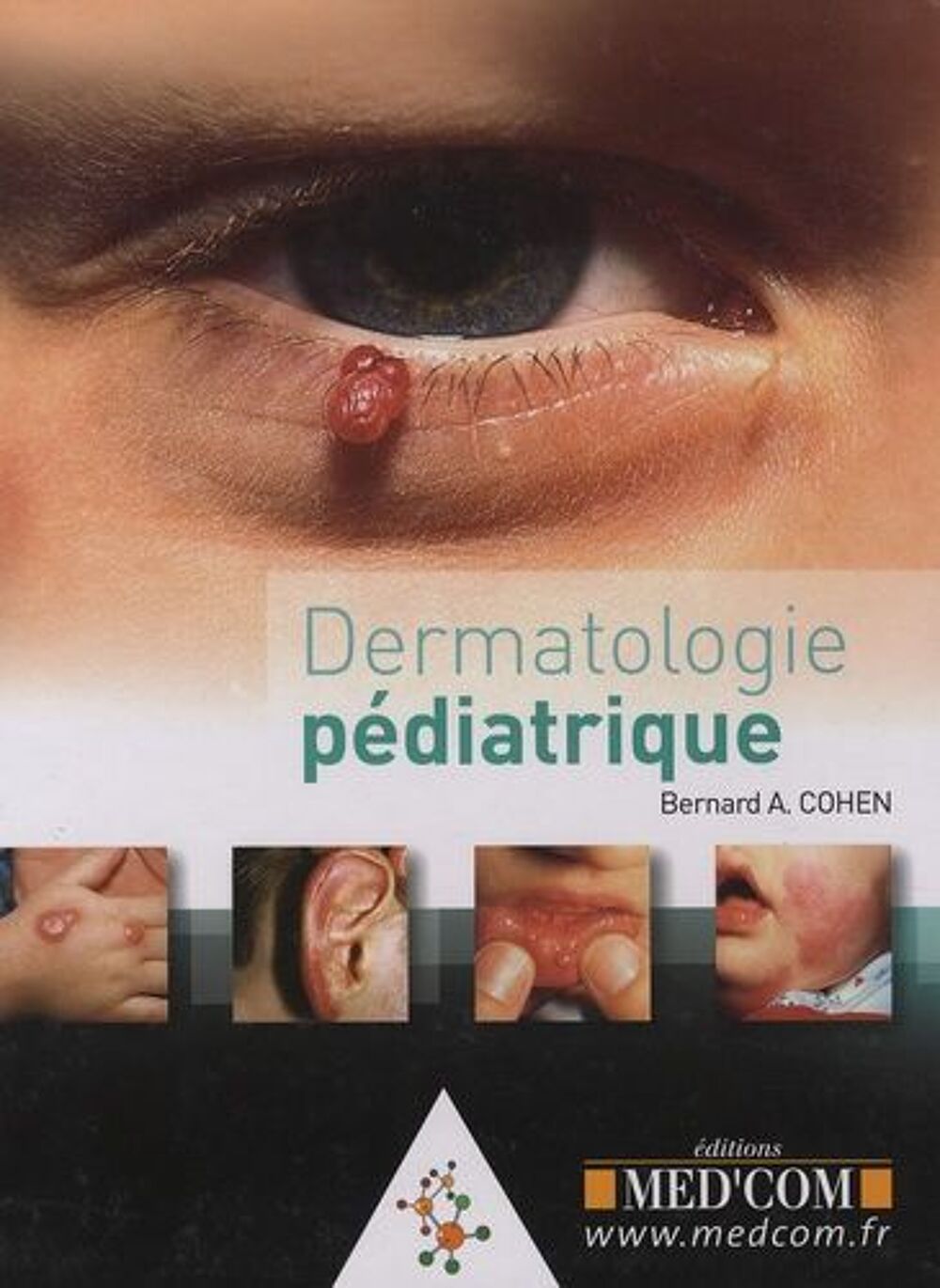Dermatologie P&eacute;diatrique /atlas diagnostique de dermatologie Livres et BD