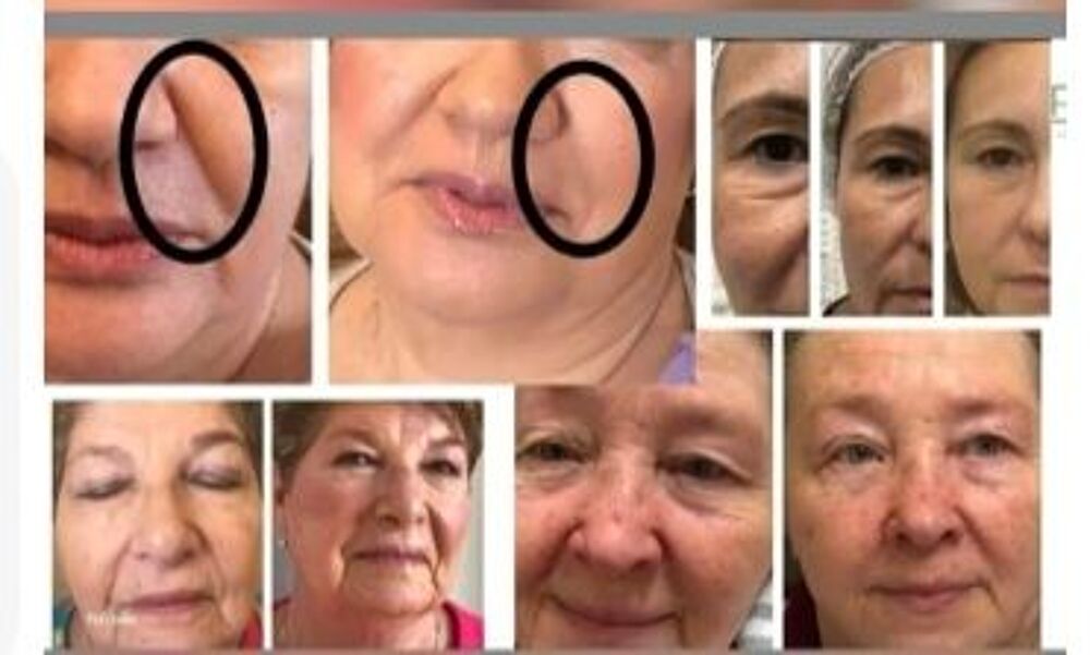   Soin du visage Gratuit pour les 100 Premiers Inscrits  